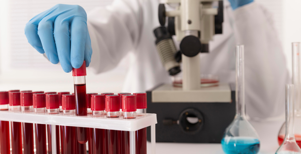 Reliable Blood Test Centre in Pune with Trusted Services